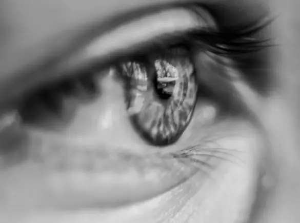 Low Vision eye image